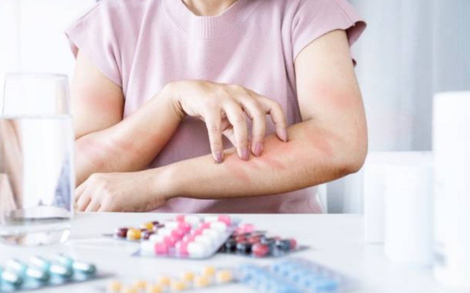 對 vardenafil 或成分過敏者